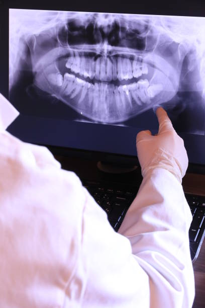 Best Emergency Dental Care for Broken or Chipped Teeth in Harrisonburg, VA